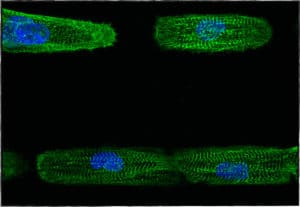 micropatterned cardiomyocyotes