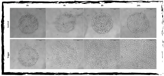 Cell migration on micropattern - 4Dcell