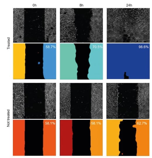 Setting up the wound healing assay using a 4DCELL dynamic micropatterned coverslip