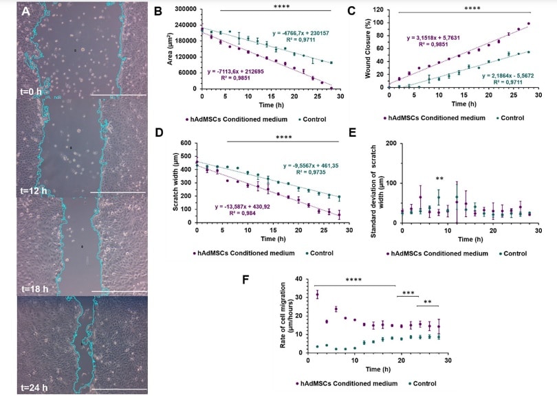 Wound healing size tool test comparing HaCaT exposed to hAdMSCs conditioned medium and HaCaT cultured only with basic medium as control of the assay