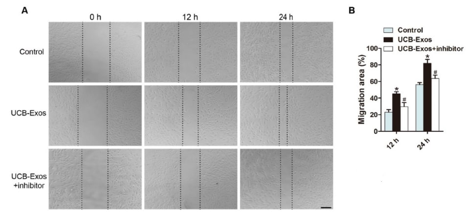 MiR-21-3p mediates the pro-angiogenic effects of exosomes (UCB-Exos) on endothelial cells (HMECs)