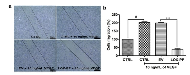 Lysyl oxidase propeptide negates the pro-angiogenic effect of vascular endothelial growth factor (VEGF) in human endothelial cells.