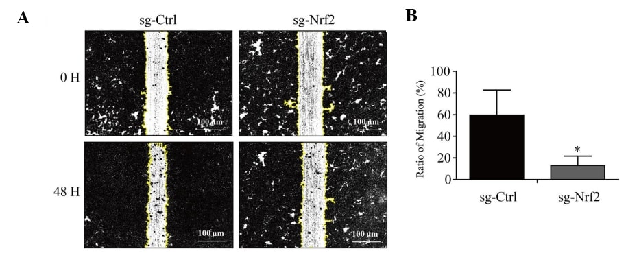 Knockout of transcription factor Nrf2 inhibits the migration of HeLa cells