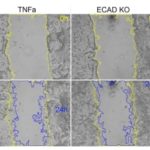 Combined effect of E-cadherin loss-of-function and pro-inflammatory activation supports a 2-hit model for E-cadherin loss in the neural crest